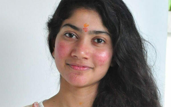Sai Pallavi: ఇకపై మొటిమల్ని దాచుకోకూడదనుకున్నా:  సాయి పల్లవి