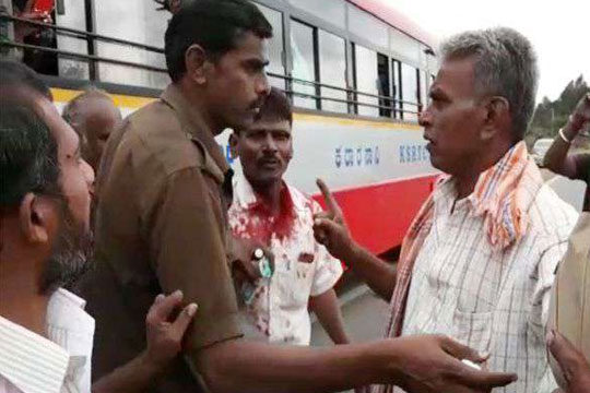 Bus Conductor Severely Hits Passenger For Rs 1