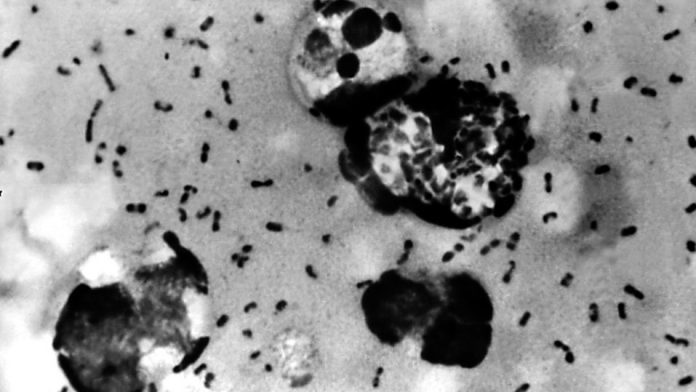 Bubonic Plague: Another Deadly Virus From China!