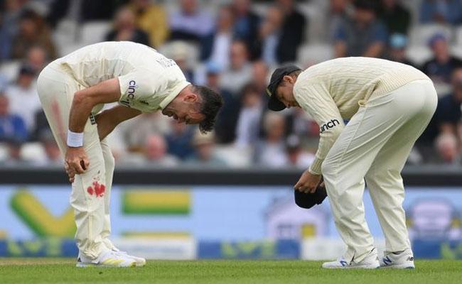 India Vs England: James Anderson Bowls With Bleeding Knee