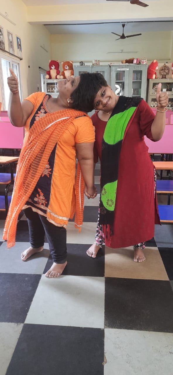 Conjoined Twins Veena & Vani secure good grades in Inter