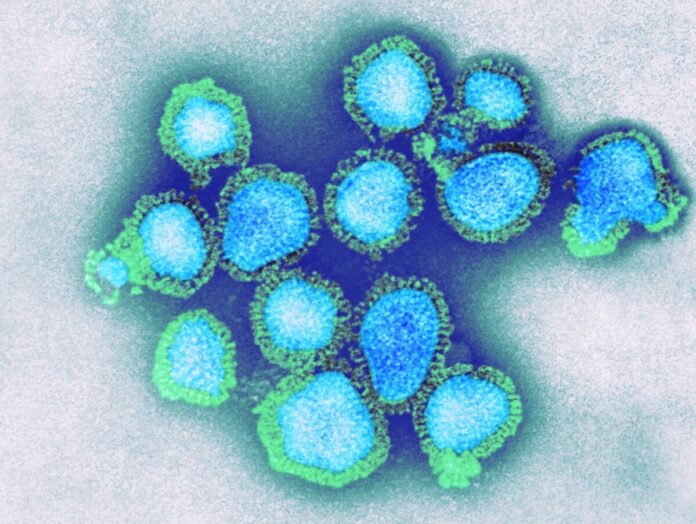 Ap Health Dept Issues Alert On H3n2 Influenza Virus!!